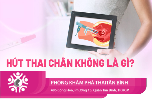 phá thai hút chân không