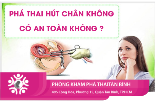 Phá thai hút chân không có an toàn không?